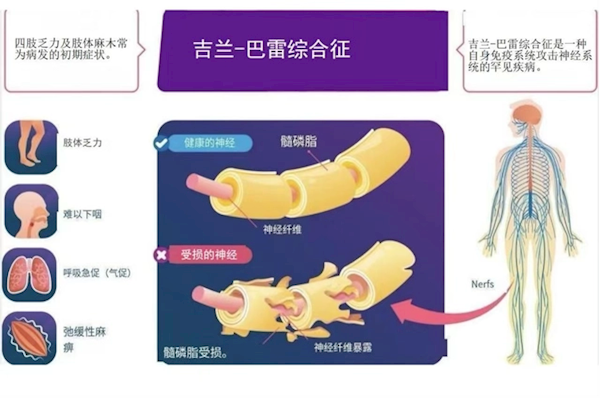 大学生因一顿烧烤进ICU 换了5次血：都怪它